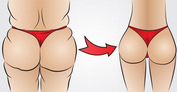 Принцип действия вакуумного массажа...