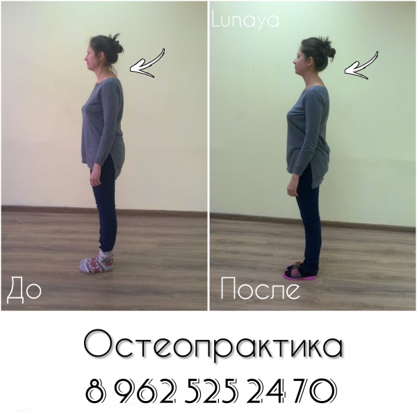 ОСТЕОпрактика - это мягкие мануальные...